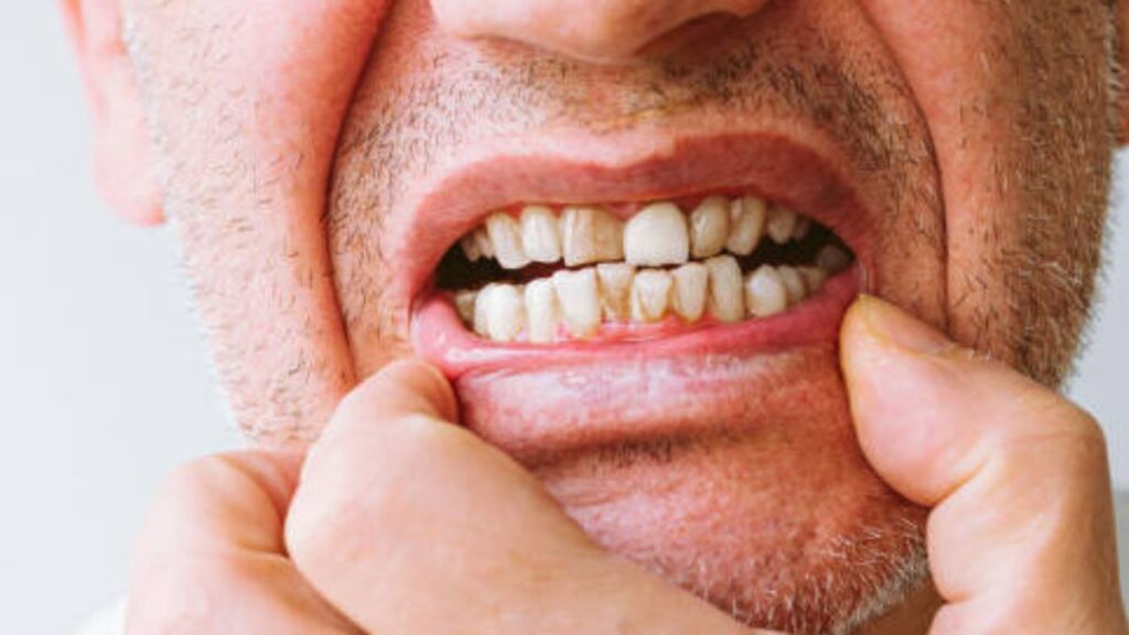 Exploring Dentiloquent: How Oral Health Influences Communication